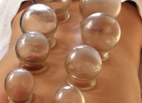 Cupping