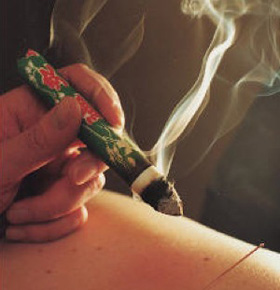 Moxibustion